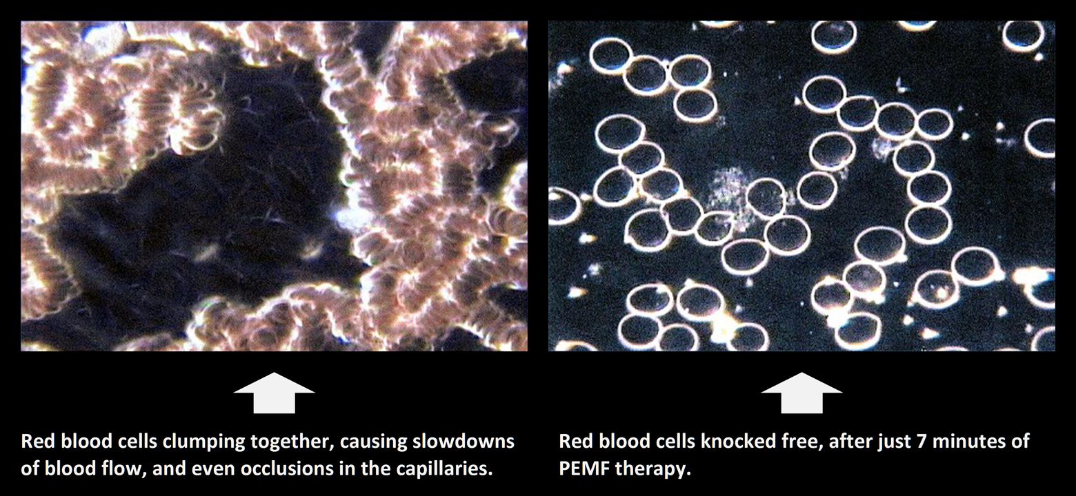 RED BLOOD CELLS